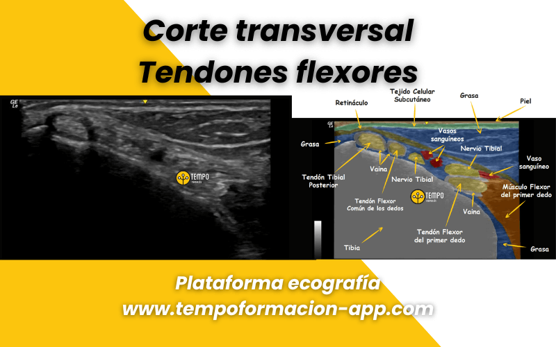 4. Anatomia ecografica Tempo Formacion.png